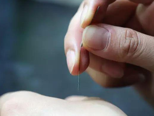 三棱針療法治療高燒嗎？